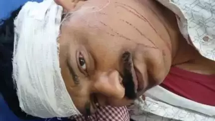 कहरा: सोनवर्षा राज थाना के सहमौरा गांव में स्कार्पियो और ऑटो की टक्कर, दो लोग जख्मी