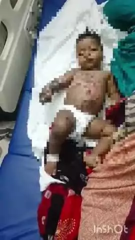 बहराइच: कोडवा में दो वर्षीय बालक पर गिरी खौलती चाय, झुलसने के बाद इलाज जारी