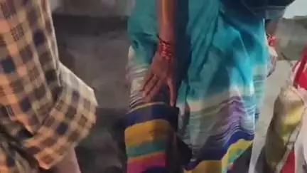 భీమిలి: మధురవాడ సర్వీస్ రోడ్డులో కాలువ పైకప్పు విరిగి పోవటంతో మహిళకు గాయాలు