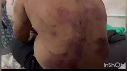 मल्हारगढ़: गांव बरखेड़ा पंथ में युवक को बंधक बनाकर मारपीट, पुलिस जाँच में जुटी