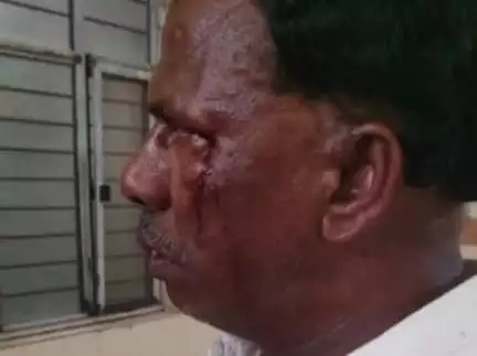 వైస్సార్ పార్టీ నాయకుడు నాగిరెడ్డి సుదర్శన్ రెడ్డి పై 
 దాడి