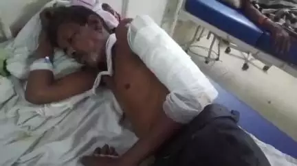 नरसिंहपुर: बरहटा गांव में दो लोगों ने बिना वजह एक व्यक्ति को लाठी-डंडे से पीटा, जिला अस्पताल में उपचार जारी