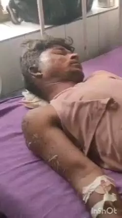 अलवर: अलवर जिले में करंट लगने से दो व्यक्ति झुलसे, दोनों को गंभीर हालत में जिला अस्पताल में भर्ती कराया गया