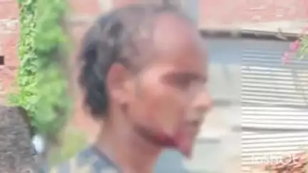 मोहम्मदी: मोहम्मदी नगर के गोला रोड पर घोड़े ने युवक पर किया जानलेवा हमला