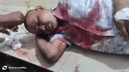 नरसिंहपुर: मारपीट में घायल युवक को तेंदूखेड़ा से गंभीर हालत में लाया गया जिला अस्पताल