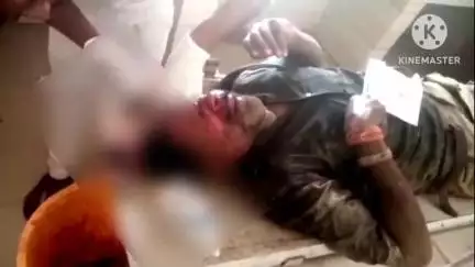 मुसाफिरखाना: भाले सुल्तान शहीद स्मारक के रानीगंज SDS स्कूल के सामने कार ने बाइक को मारी टक्कर, चाचा-भतीजा सहित नाबालिग बच्चा घायल