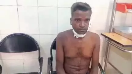 बरेली: थाना बारादरी क्षेत्र के गंगापुर पक्का बाग निवासी हरीश पर ब्लेड से किया गया हमला, घायल का हुआ उपचार