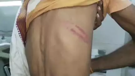 महोबा: इमलिया गांव में दबंग का कहर, पैदल जा रहे व्यक्ति को लाठियों से पीटकर किया लहूलुहान