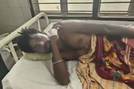 పుంగనూరు: కంగా నెల్లూరు గ్రామ సమీపంలో అగ్ని ప్రమాదంలో వలస కార్మికునికి గాయాలు