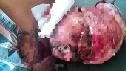 दमोह: हटा के SBN कॉलेज के पास अज्ञात वाहन ने बाइक सवारों को मारी टक्कर, एक की मौत, दूसरा जबलपुर में भर्ती
