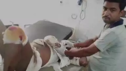 सारठ: देवघर मार्ग पर रानीगंज गांव के पास ट्रक की टक्कर से बाइक सवार गंभीर घायल, देवघर रेफर, ट्रक जब्त