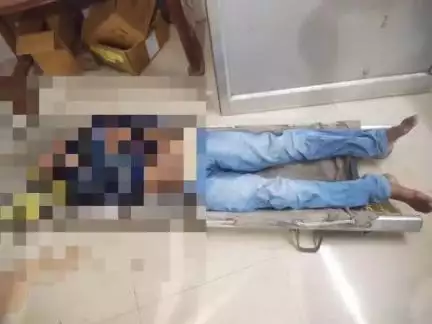 ବୌଦ୍ଧ ସଦର: ପୁରୁଣାକଟକ ଅଂଚଳର ସ୍ୱାଦିଷ୍ଟ ହୋଟେଲ ନିକଟରେ ବାଇକ ଧକ୍କା ରେ ଦୁଇଗୁରୁତର