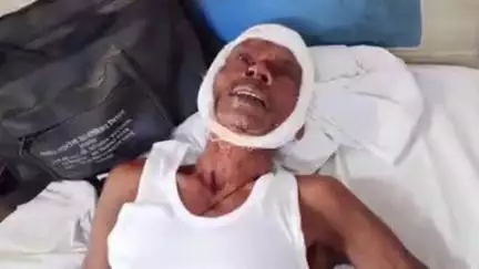 फतेहपुर: मलवां के आदमपुर में पत्नी ने अपनी बेटी के साथ मिलकर पति की पिटाई की, आई गंभीर चोट