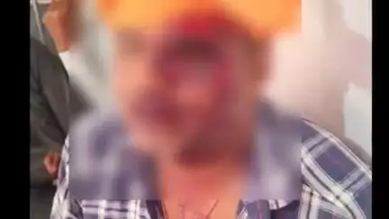 पाली: ग्राम गौना के पास बाइक असंतुलित होकर डिवाइडर से टकराई, बाइक सवार गंभीर रूप से घायल