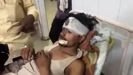 खरगापुर: कुड़ीला के पास सड़क हादसे में एक व्यक्ति गंभीर रूप से घायल, सीएचसी खरगापुर से ज़िला अस्पताल रेफर