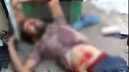 सेमरिया चौक स्थित चौपाटी के समीप एक युवक पर चाकू से किया गया हमला, जिला अस्पताल में उपचार जारी