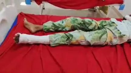 कप्तानगंज: सिंघहा रेगुलेटर के पास सामने से आ रही गाड़ी की लाइट से अनियंत्रित होकर गिरने से बाइक सवार 3 लोग हुए घायल