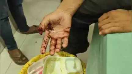 सफीपुर: सफीपुर थाना क्षेत्र के जमालुद्दीनपुर गांव के पास शराब सेल्समैन से लूट, लुटेरों ने काटा अंगूठा, पुलिस जांच में जुटी