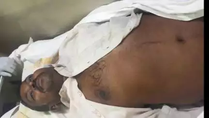 పాణ్యం: పెద్దపాడు గ్రామ సమీపంలో ఫిట్స్‌తో గుర్తుతెలియని వ్యక్తి మృతి