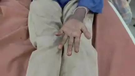 फर्रुखाबाद: ग्राम रामपुर ढपरपुर में खेत में भुट्टा तोड़ते समय 9 वर्षीय बालिका को सांप ने काटा, अस्पताल में कराया गया भर्ती