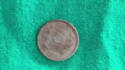 चम्पावत: जिला अस्पताल में डॉक्टर ने दूरबीन विधि से बच्चों के गले में फंसे सिक्के को सफलतापूर्वक निकाला