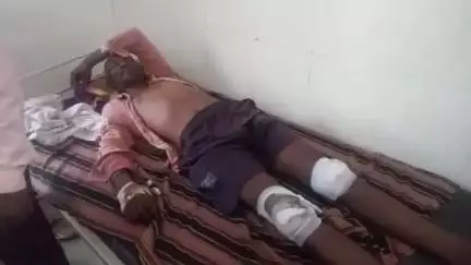 गोपद बनास: सीधी जिले के चौफाल में तेज रफ्तार बाइक दुर्घटनाग्रस्त, चालक गंभीर रूप से घायल