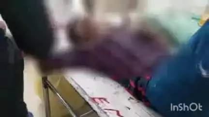 बिजनौर: बिजनौर के चांदपुर में जलीलपुर मार्ग पर अनियंत्रित बाइक पुलिया से टकराई, एक युवक गंभीर घायल
