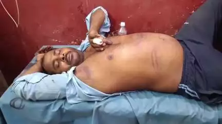 मंझनपुर: टीका का पूरा में पत्नी को लेकर विवाद, बोले- हम रखेंगे, विरोध करने पर बेरहमी से पीटा, जान से मारने की दी धमकी