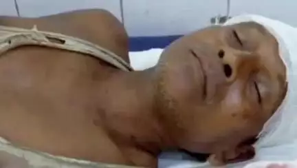 पटमदा: पटमदा में ज़मीन विवाद में दो पक्षों के बीच हिंसक झड़प, एक घायल, मामला दर्ज, पुलिस जांच में जुटी