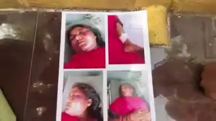 टीकमगढ़: ससुराल पक्ष ने मांगे ₹10 लाख, बेरहमी से की मारपीट, घायल महिला एसपी कार्यालय पहुंची