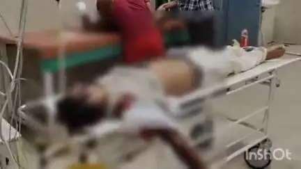 फर्रुखाबाद: जहानगंज बघार रोड पर दो बाइकों की भिंडत में एक व्यक्ति मृत घोषित, एक घायल का जिला अस्पताल लोहिया में उपचार जारी