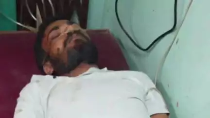 पारू: मनिकपुर पारु रोड पर शेखौना के पास बाइक सवार अपराधियों ने मां-बेटे से पर्स और मोबाइल छीना, दोनों घायल
