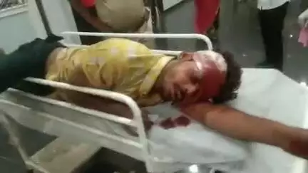 बनेड़ा: रायला में दो बाइकों की आपस में हुई जोरदार भिड़ंत, हादसे में दोनों बाइक सवार युवक हुए घायल