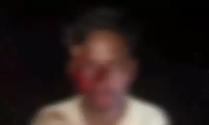 रीठी: निर्रटा में मवेशियों से टकराई बाइक, तीन लोग घायल, ज़िला अस्पताल भेजे गए