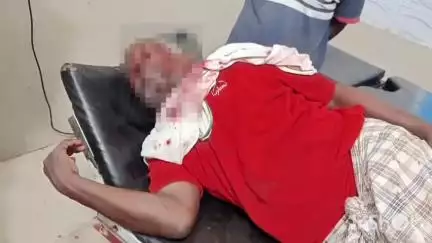 भवनाथपुर: हरिहरपुर ओपी के रपुरा गांव में जमीनी विवाद में मारपीट, देवधारी सिंह गंभीर घायल