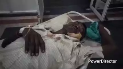 अमदाबाद: बैरिया में दो बाइकों की टक्कर में एक व्यक्ति घायल, हालत गंभीर होने पर हायर सेंटर रेफर