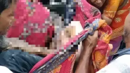 হাড়োয়া: নজরনগর এলাকায় গ্যাসের আগুনে অগ্নিদগ্ধ যুবক, আশঙ্কাজনক অবস্থায় RG কর হাসপাতালে রেফার