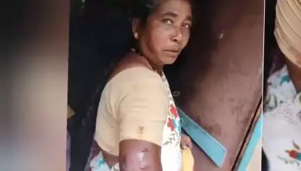ಹಿರಿಯೂರು: ಅಮ್ಮನಹಟ್ಟಿ ಗ್ರಾಮದಲ್ಲಿ ಕೋತಿಗಳ ದಾಳಿ, ಮಹಿಳೆಗೆ ಗಾಯ