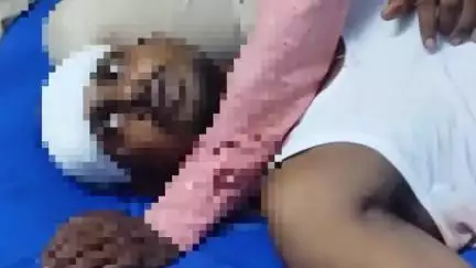 মঙ্গলকোট: নিগনে মোটরভ্যান ও বাইকের মুখোমুখি ধাক্কায় গুরুতর আহত 3 জন