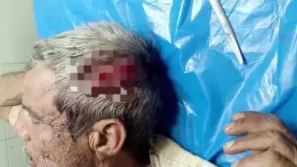 बहोरीबंद: भकरवारा में जमीनी विवाद में वृद्ध पर जानलेवा हमला, गंभीर हालत में अस्पताल रेफर