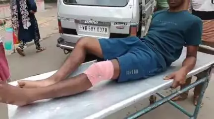 বহরমপুর: সাটুয়ে ফুটবল খেলতে গিয়ে পা ভেঙে আহত এক কিশোর, বহরমপুরMMC&H-এ চিকিৎসার জন্য আনা হয়