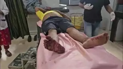 सुनौरा के पास दो बाइकों की भिड़ंत में तीन घायल, सतना जिला अस्पताल में भर्ती, पुलिस जांच जारी