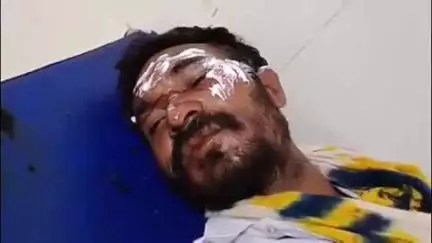 छिंदवाड़ा नगर: रोहना खुर्द से चौरई जाते समय सड़क हादसे में पिता-पुत्री घायल, जिला अस्पताल में इलाज जारी