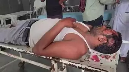 बैतूल नगर: ससुराल से लौटते वक़्त शराब के नशे में बाइक स्लिप होने से व्यक्ति गंभीर रूप से घायल, अस्पताल में भर्ती