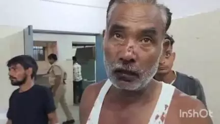 बरेली: प्रेम नगर थाना क्षेत्र हार्टमैंन रामलीला गोटिया में कलयुगी बेटे ने नशे में पिता के साथ की मारपीट, पिता हुआ लहूलुहान