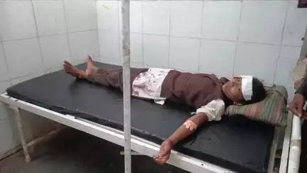 कटंगी: बाइक की टक्कर से कामठी की स्कूली छात्रा घायल, दाहिना हाथ टूटा, ज़िला अस्पताल बालाघाट रेफर