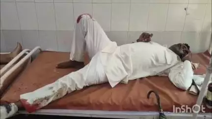 जलालाबाद: गोरा मोड पर ट्रक को बचाने के चक्कर में ई-रिक्शा पलटा, दो कावड़िये घायल