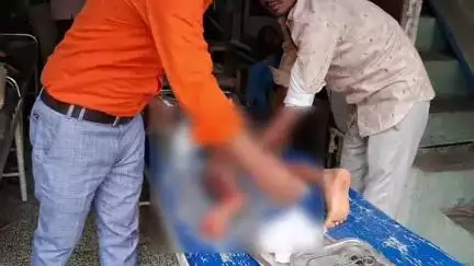 बिल्सी: परोली गांव में घर के बाहर खेल रहे एक मासूम बच्चे पर बंदरों ने किया हमला, घायल बच्चे को अस्पताल में कराया भर्ती