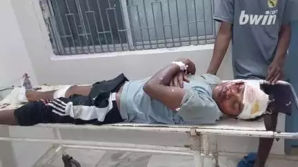 लोहरदगा: पिकअप और बाइक की टक्कर में बाइक सवार गंभीर रूप से घायल, अस्पताल में भर्ती