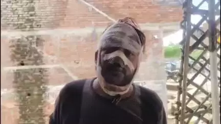 हमीरपुर: मिहुना गांव के पास कार सवार दबंगों ने फैक्ट्री कर्मी को लहुलुहान किया, ड्यूटी से वापस जाते समय मिहुना में हुई घटना